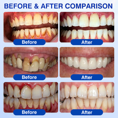 🇺🇸🦷✅️✨Evolvion® GumRevive Periodontal Repair Gel