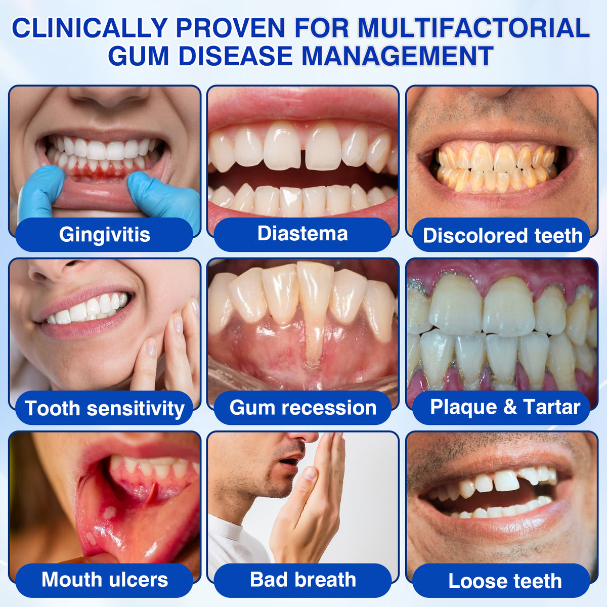 🇺🇸🦷✅️✨Evolvion® GumRevive Periodontal Repair Gel
