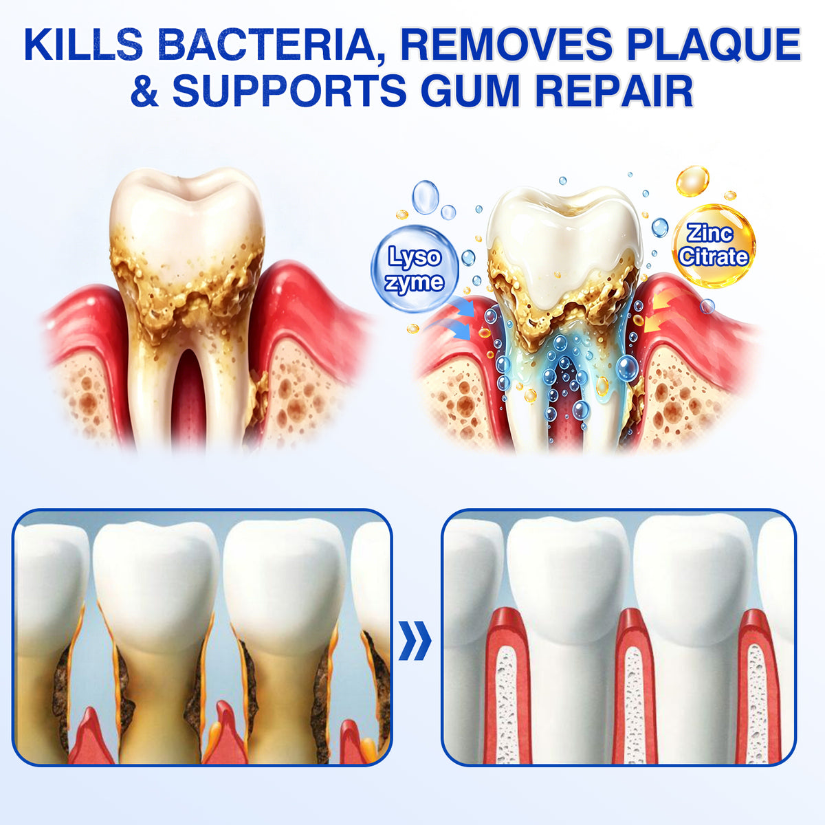 🇺🇸🦷✅️✨Evolvion® GumRevive Periodontal Repair Gel