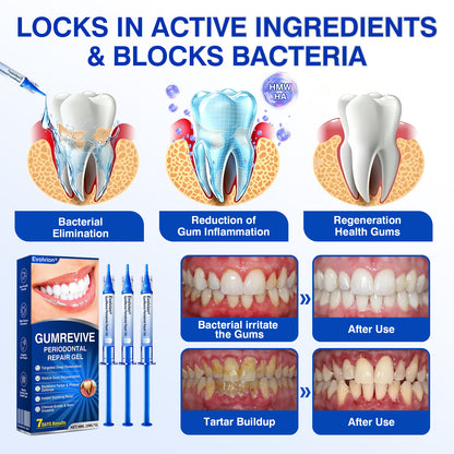 🇺🇸🦷✅️✨Evolvion® GumRevive Periodontal Repair Gel