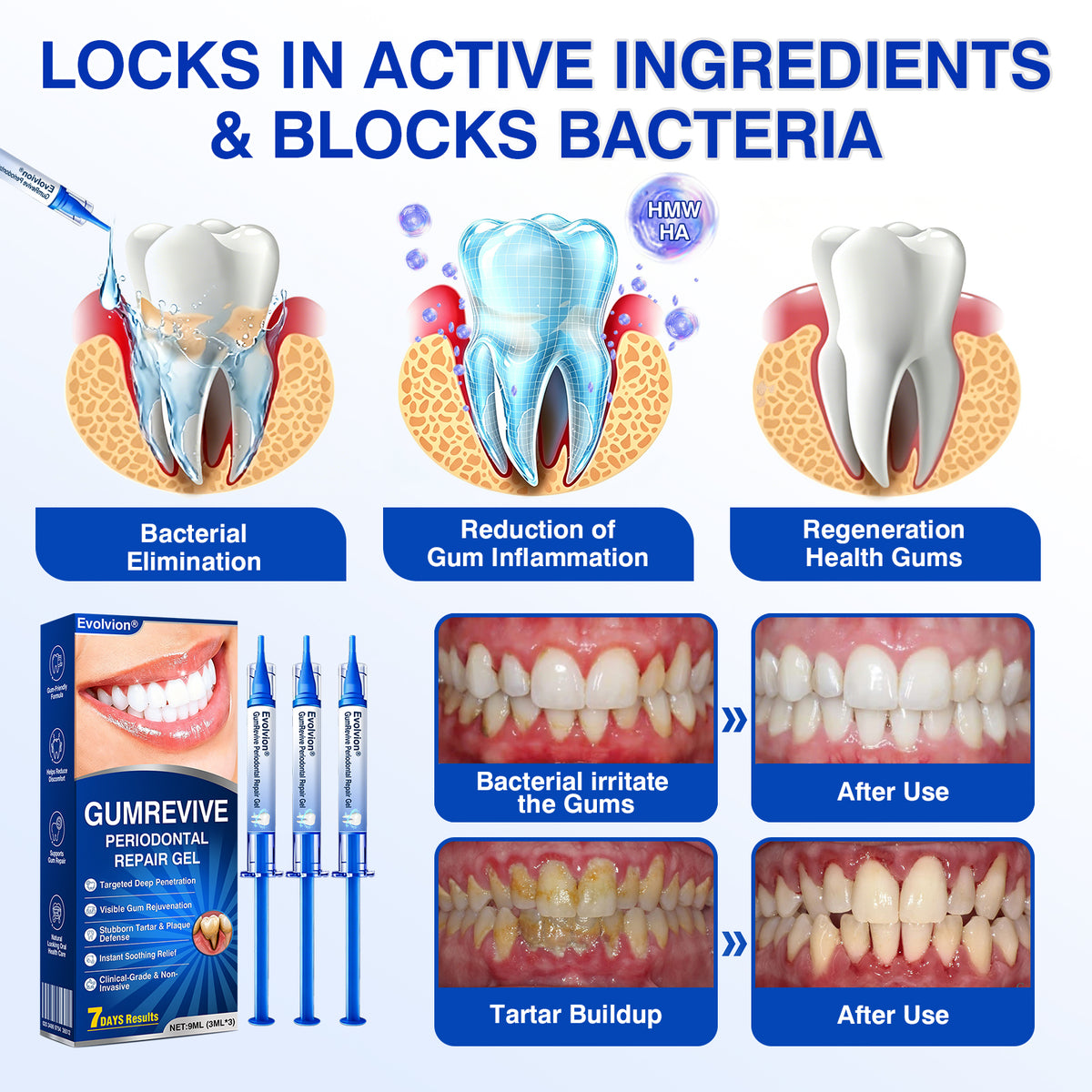 🇺🇸👨‍⚕️✅😁Evolvion® GumRevive Periodontal Repair Gel