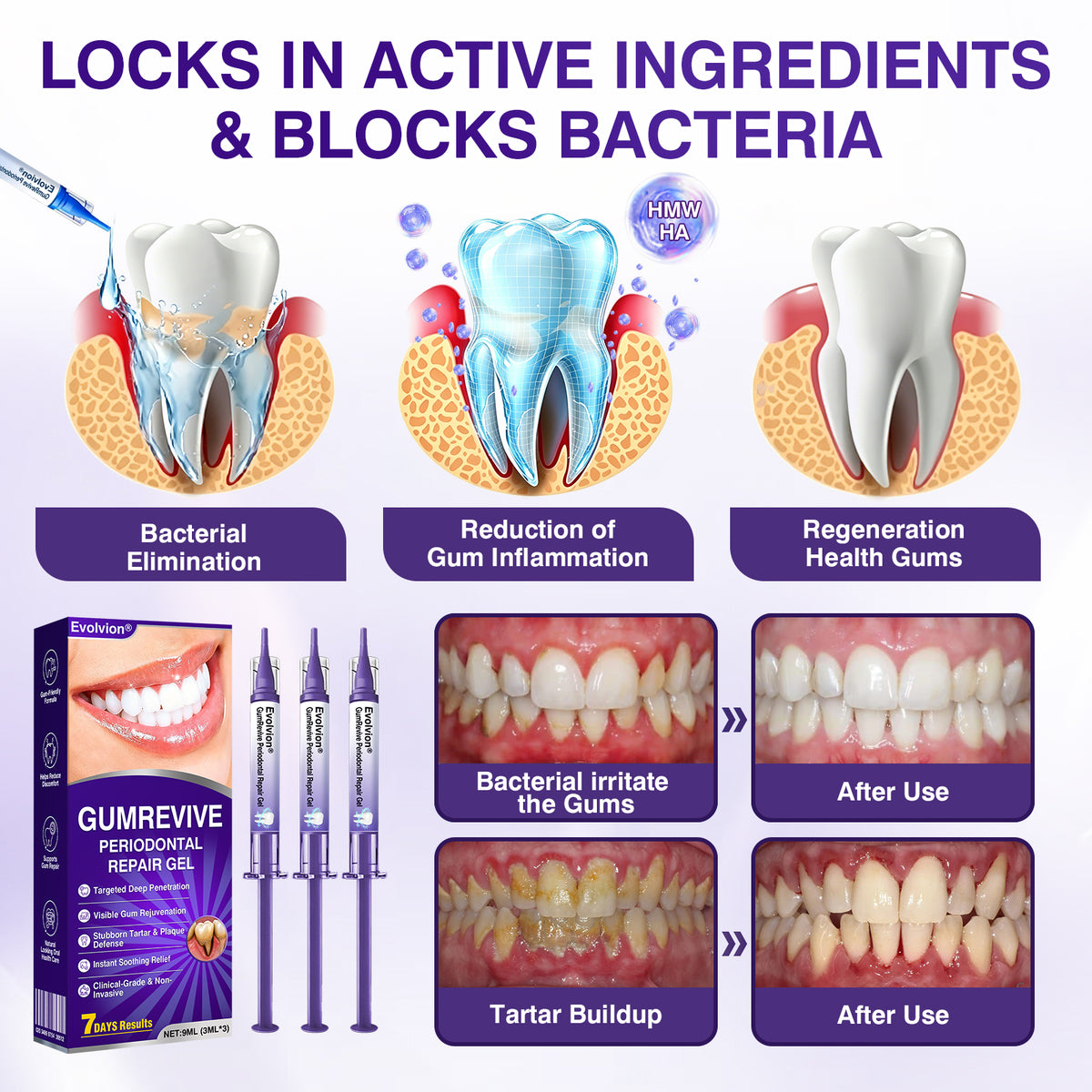 🇺🇸👨‍⚕️✅️Advanced Formula🦷Evolvion® GumRevive Periodontal Repair Gel